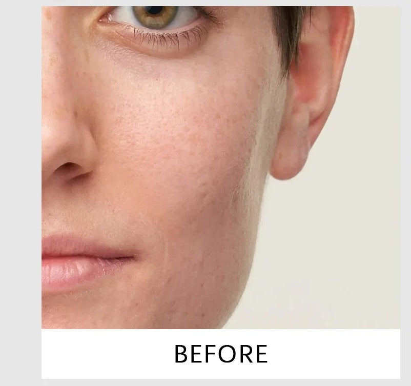 Korean Exfoliating Facial Serum Cleansing Pores Remove Dead Skin Purify Oil Control Smoothing Brightening Moisturizing Ampoule