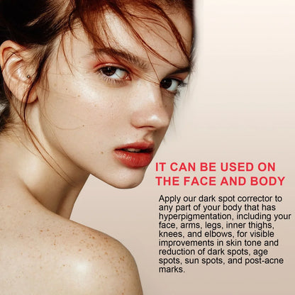 Melanin Correcting Serum Whitening Repairing Pigmentation Remove Melasma Brightening Dark Spots Anti Aging Fade Freckles Serum
