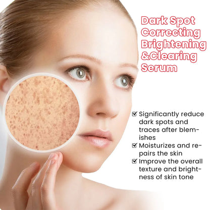 Melanin Correcting Serum Whitening Repairing Pigmentation Remove Melasma Brightening Dark Spots Anti Aging Fade Freckles Serum