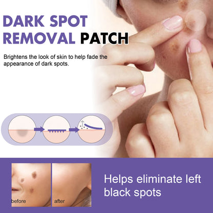 Spot-removing patches - for lightening facial dark spots, chloasma, pigmentation and melanin; moisturizing skin, spot patches