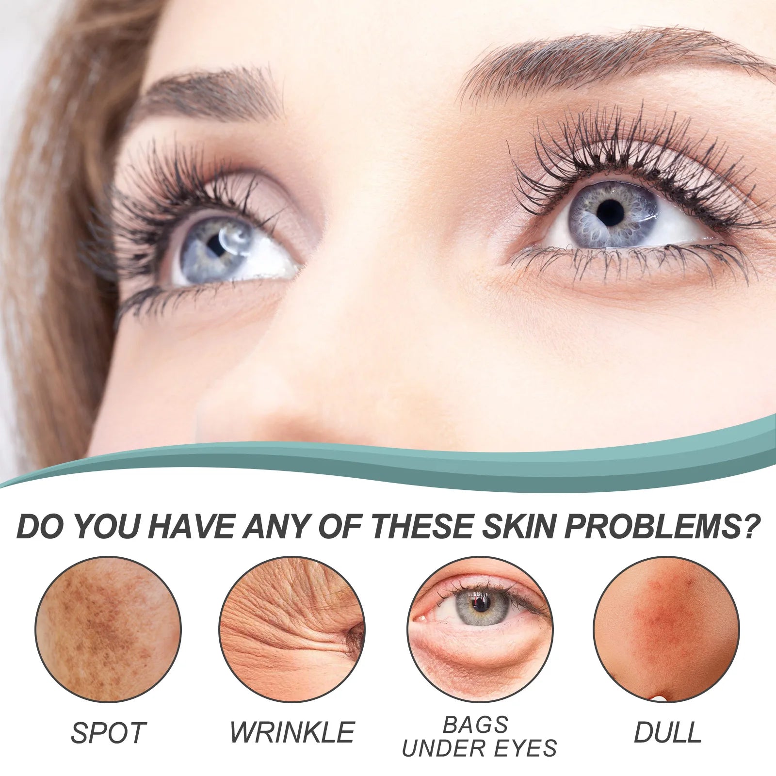 EELHOE Dark Spot Remover Face Cream Pigmentation Removal Melasma Remove Deep Hydration Skin Brightening Anti Freckle Cream 30g