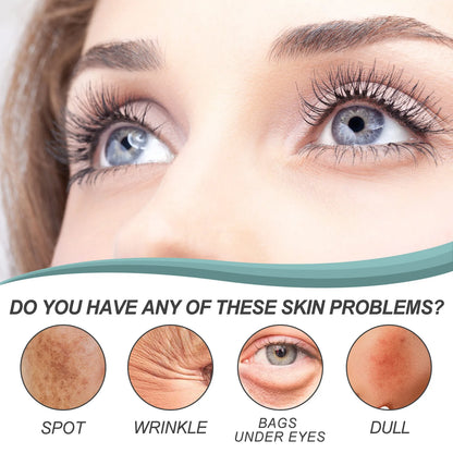 EELHOE Dark Spot Remover Face Cream Pigmentation Removal Melasma Remove Deep Hydration Skin Brightening Anti Freckle Cream 30g